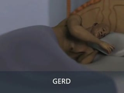 GERD Reflü