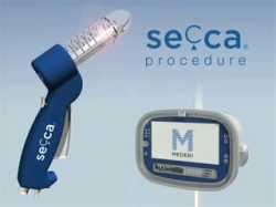 SECCA ANİMASYONU